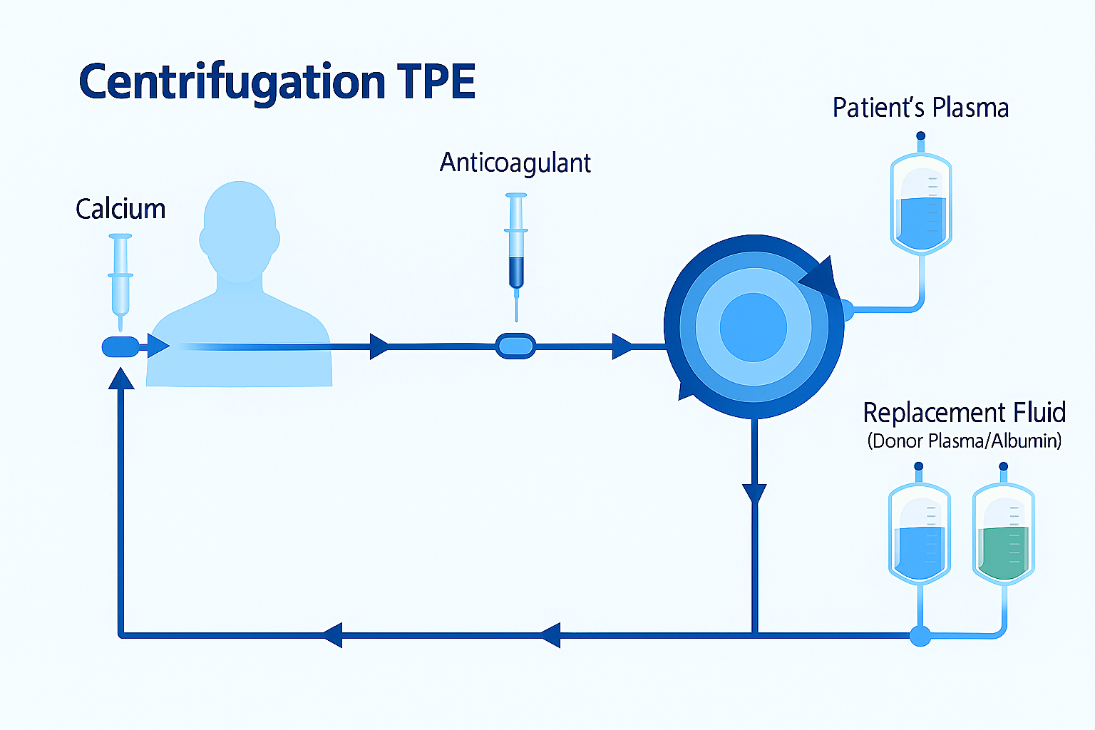 Therapeutic Plasma Exchange (TPE) treatment process at Longevity Healthcare